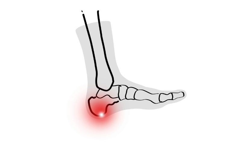 Heel Pain When Walking