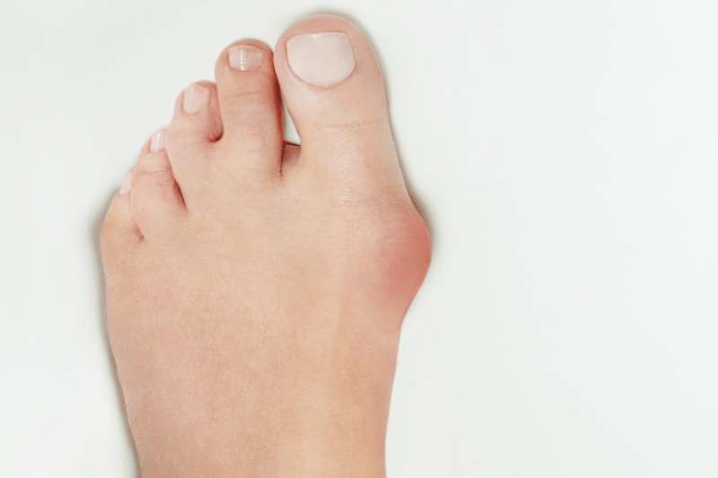 Hallux-Schiene oder funktionelle Socken? Was Kunden vor dem Kauf wissen sollten