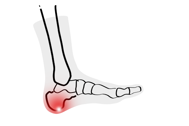 Where INFINIRI Comfort Socks Come In