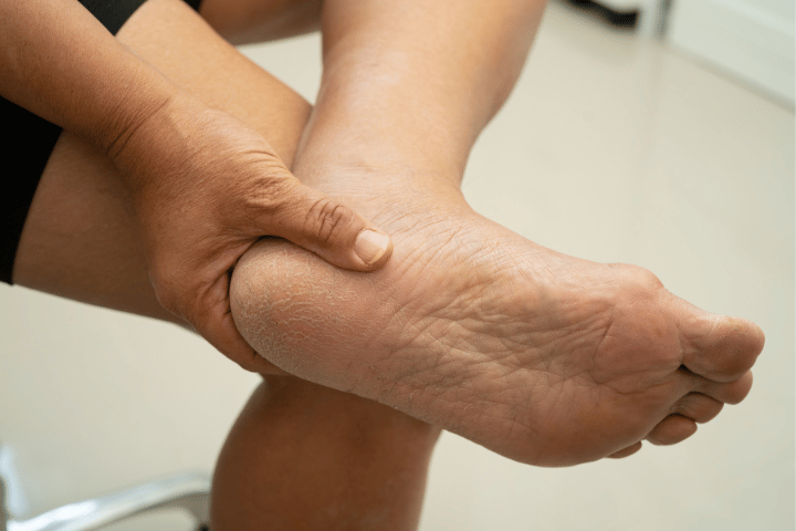 Why Does My Heel Hurt When Walking?