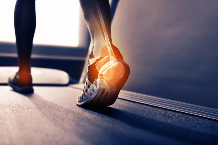 What Can Improve Heel Comfort in Everyday Life?