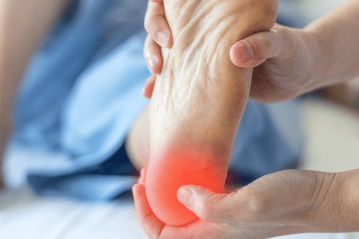 Insoles for Heel Spur: When Can Insoles Be Useful